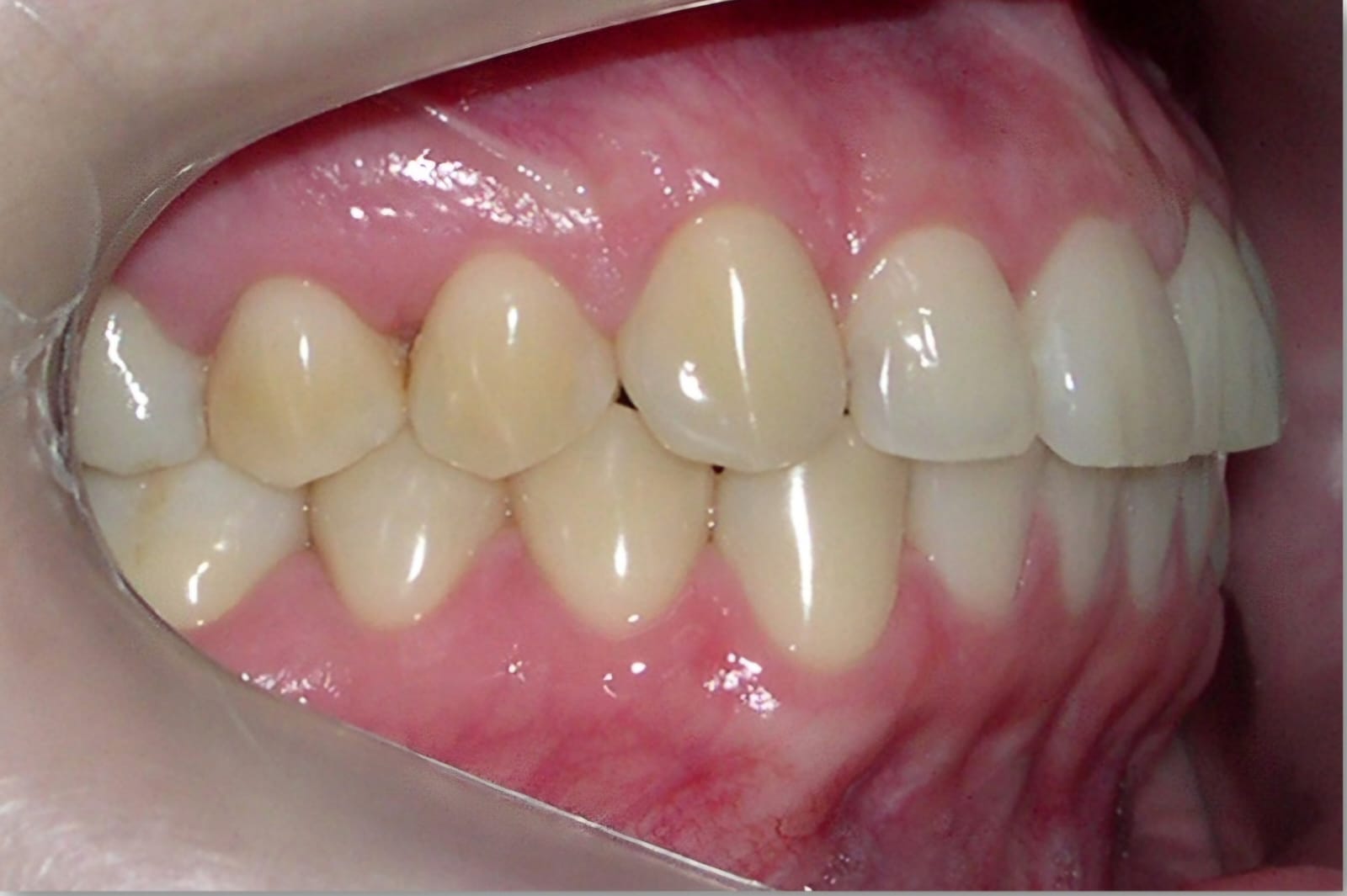 Finalização em Ortodontia